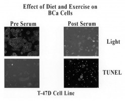 Before and after cancer cell death